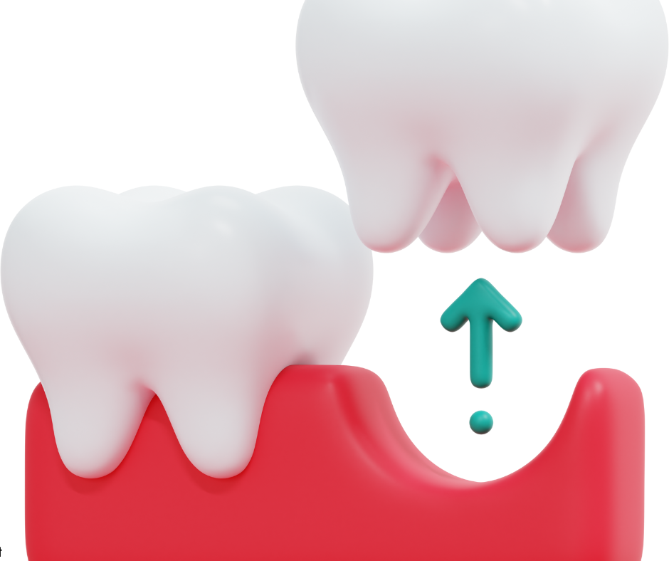 Tooth Extractions in Grand Rapids