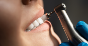 Dental Cleaning - Emergency Dental of Grand Rapids