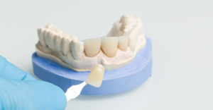 Dental Crown - Emergency Dental of Grand Rapids