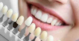 Whitening - Emergency Dental of Grand Rapids